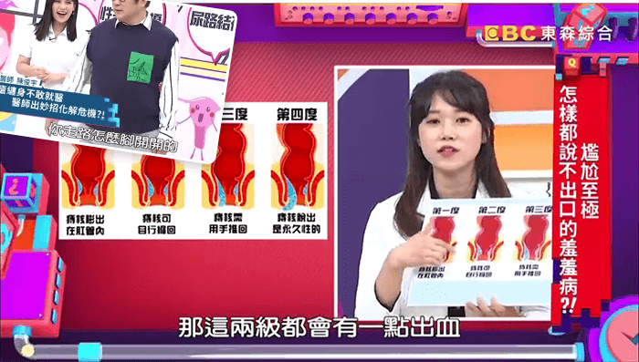 下面太大受不了中年婦女遇人生第2春卻因私密處問題好困擾醫師好辣 賴昕隄 潘若迪